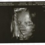 30 weeks