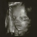 30 weeks (2)